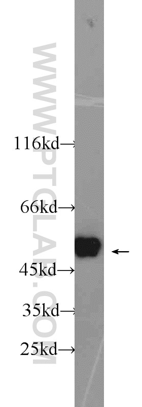 Western Blot (WB) analysis of HepG2 cells using PSMC3 Polyclonal antibody (24142-1-AP)