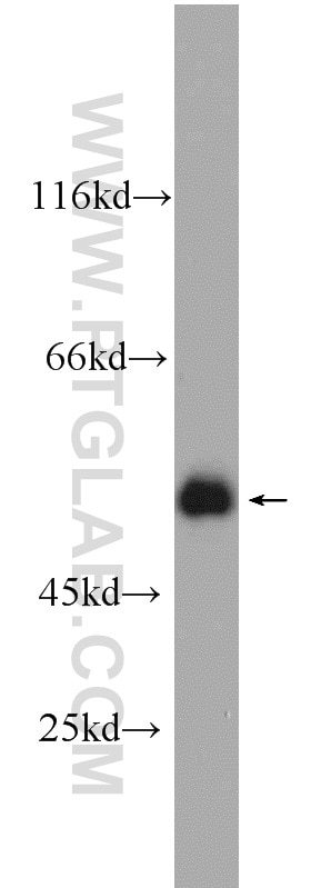 Western Blot (WB) analysis of A431 cells using PSMC3 Polyclonal antibody (24142-1-AP)
