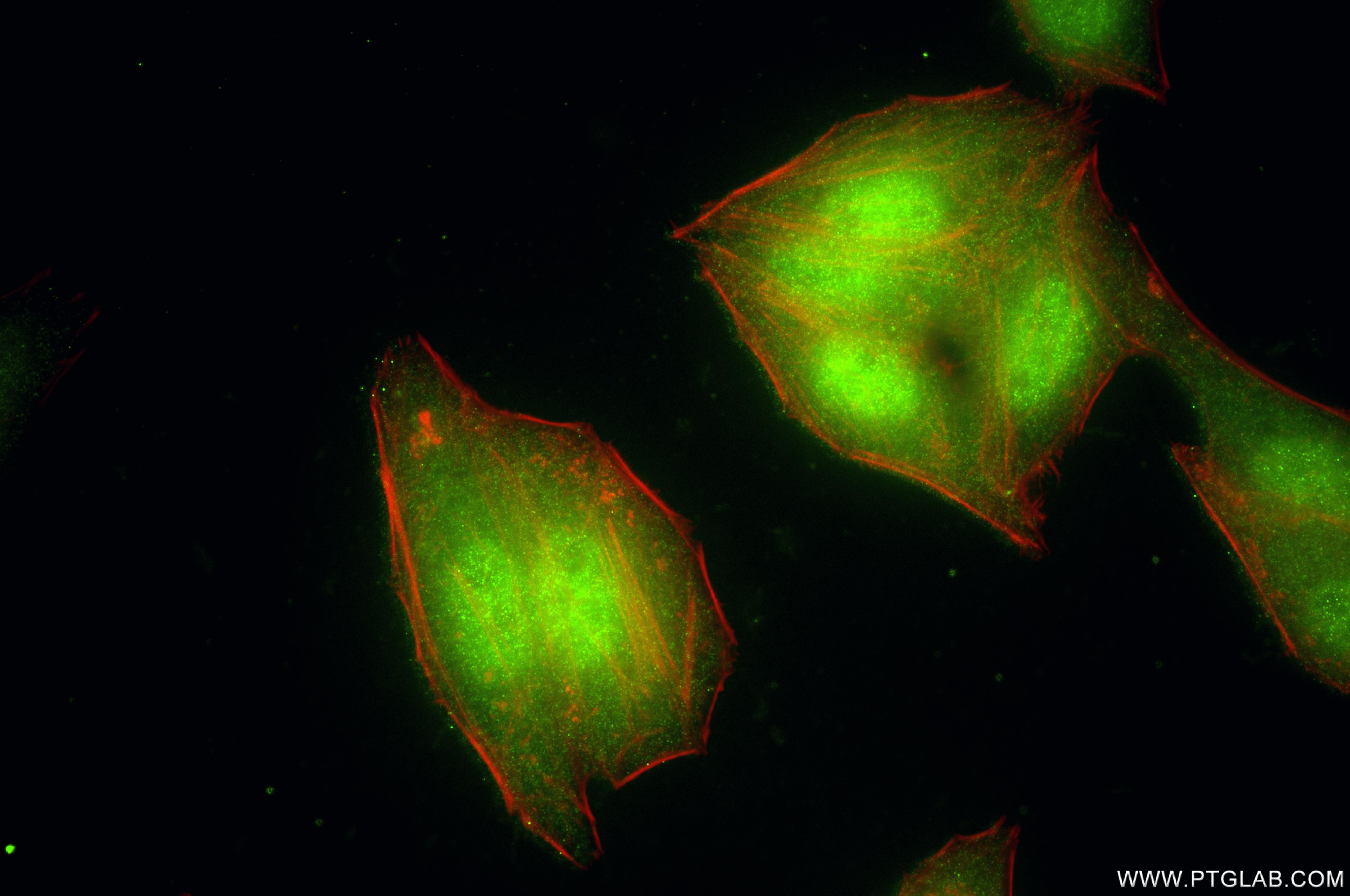 Immunofluorescent analysis of (4% PFA) fixed HepG2 cells using PSMC3 antibody (87128-4-RR, Clone: 252375C1 ) at dilution of 1:400 and CoraLite®488-Conjugated Goat Anti-Rabbit IgG(H+L) (SA00013-2), CL594-Phalloidin (red). This data was developed using the same antibody clone with 87128-4-PBS in a different storage buffer formulation. Immunofluorescence (IF) / fluorescent staining of HepG2 cells using PSMC3 Recombinant monoclonal antibody (87128-4-RR)