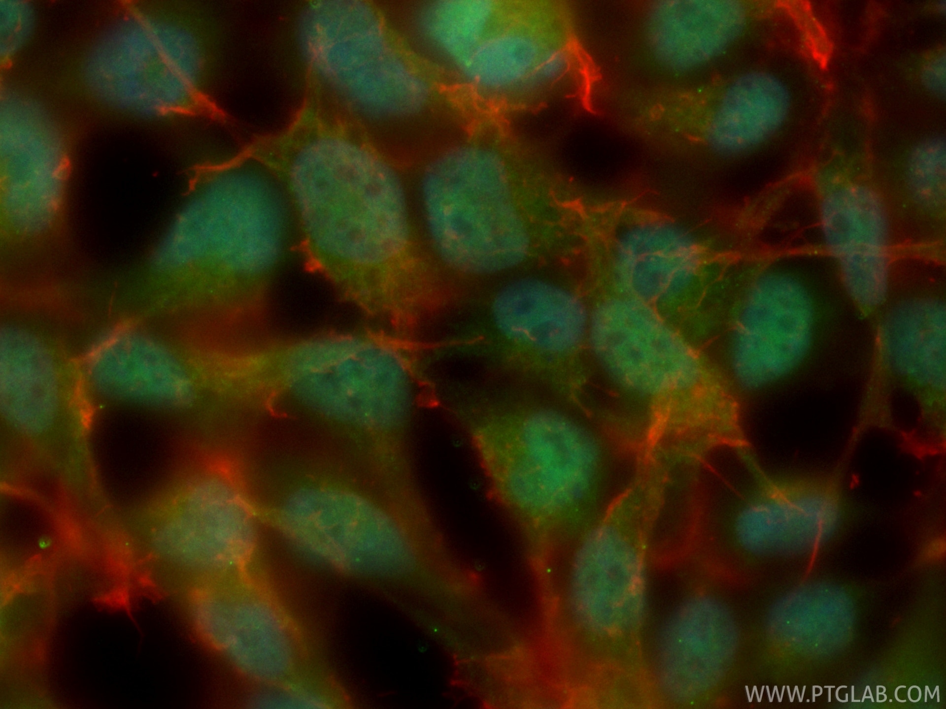 IF Staining of HEK-293 using CL488-87128-4 Immunofluorescence (IF) / fluorescent staining of HEK-293 cells using CoraLite® Plus 488-conjugated PSMC3 Recombinant mo (CL488-87128-4)