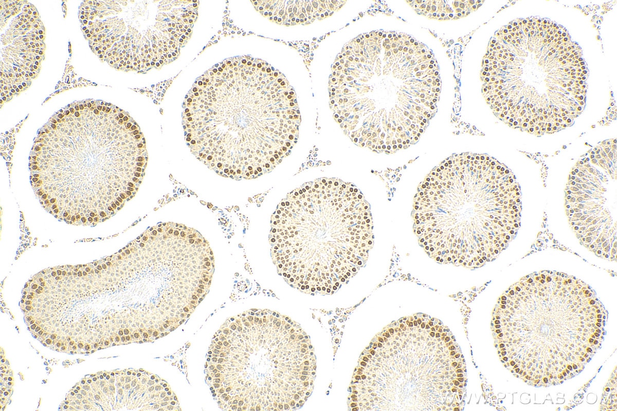 IHC staining of rat testis using 11339-1-AP