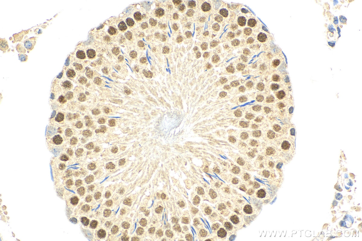 IHC staining of rat testis using 11339-1-AP