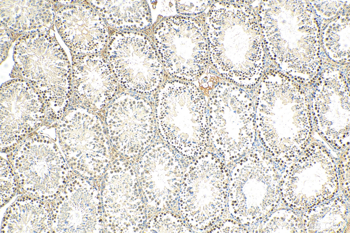 IHC staining of mouse testis using 11339-1-AP
