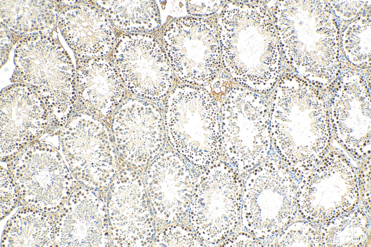 Immunohistochemistry (IHC) staining of mouse testis tissue using HOP2 Polyclonal antibody (11339-1-AP)