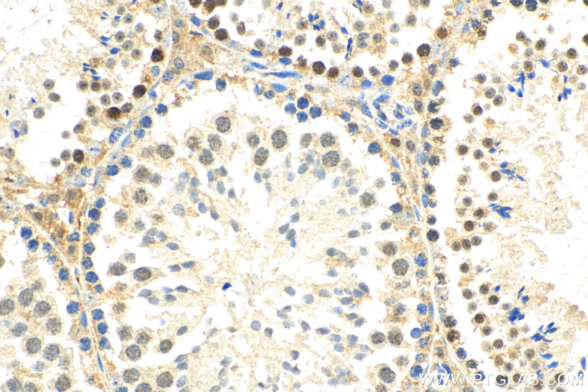 Immunohistochemistry (IHC) staining of mouse testis tissue using HOP2 Polyclonal antibody (11339-1-AP)