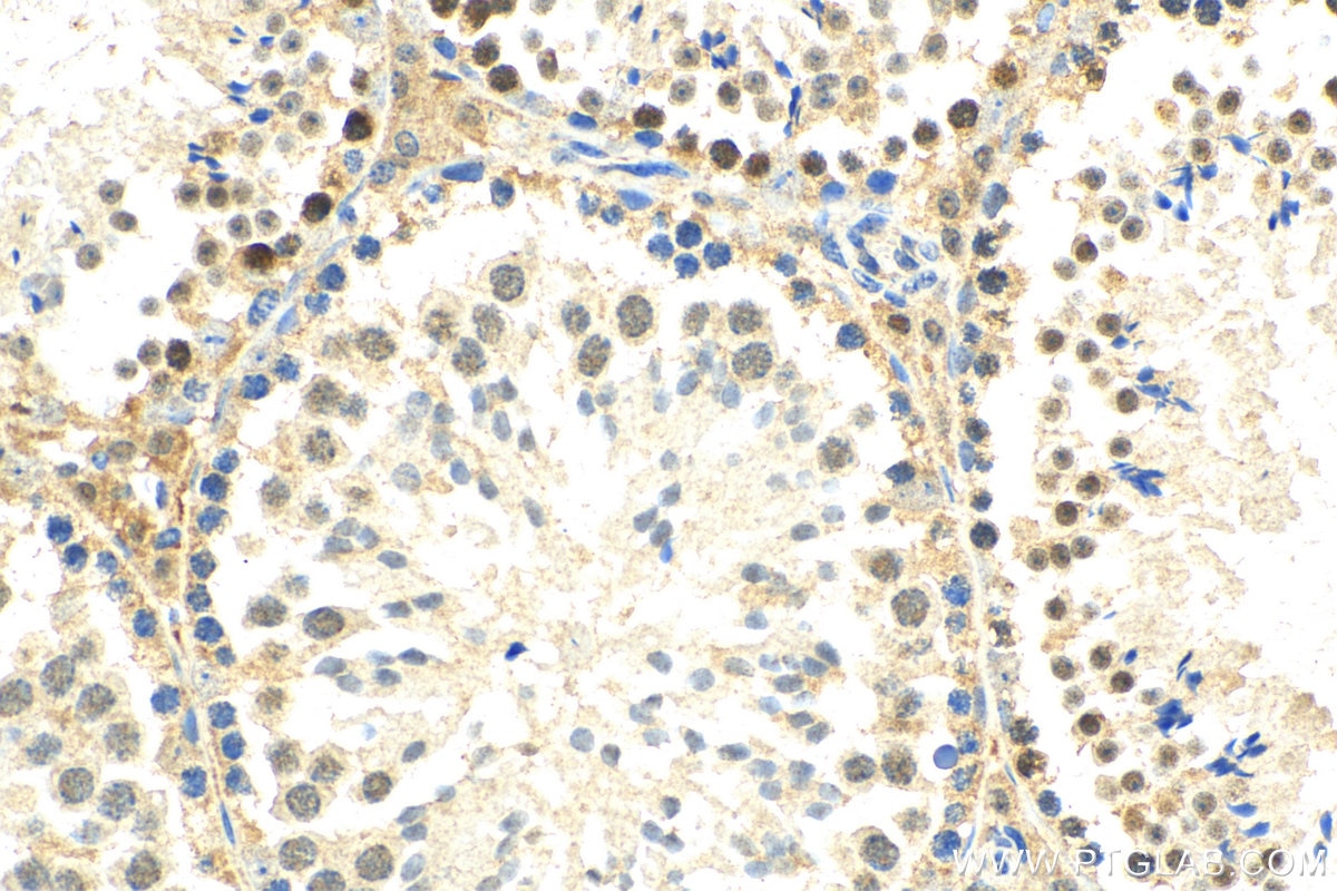 IHC staining of mouse testis using 11339-1-AP