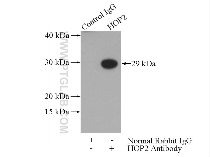 Immunoprecipitation (IP) experiment of Jurkat cells using HOP2 Polyclonal antibody (11339-1-AP)