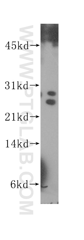 Western Blot (WB) analysis of K-562 cells using HOP2 Polyclonal antibody (11339-1-AP)