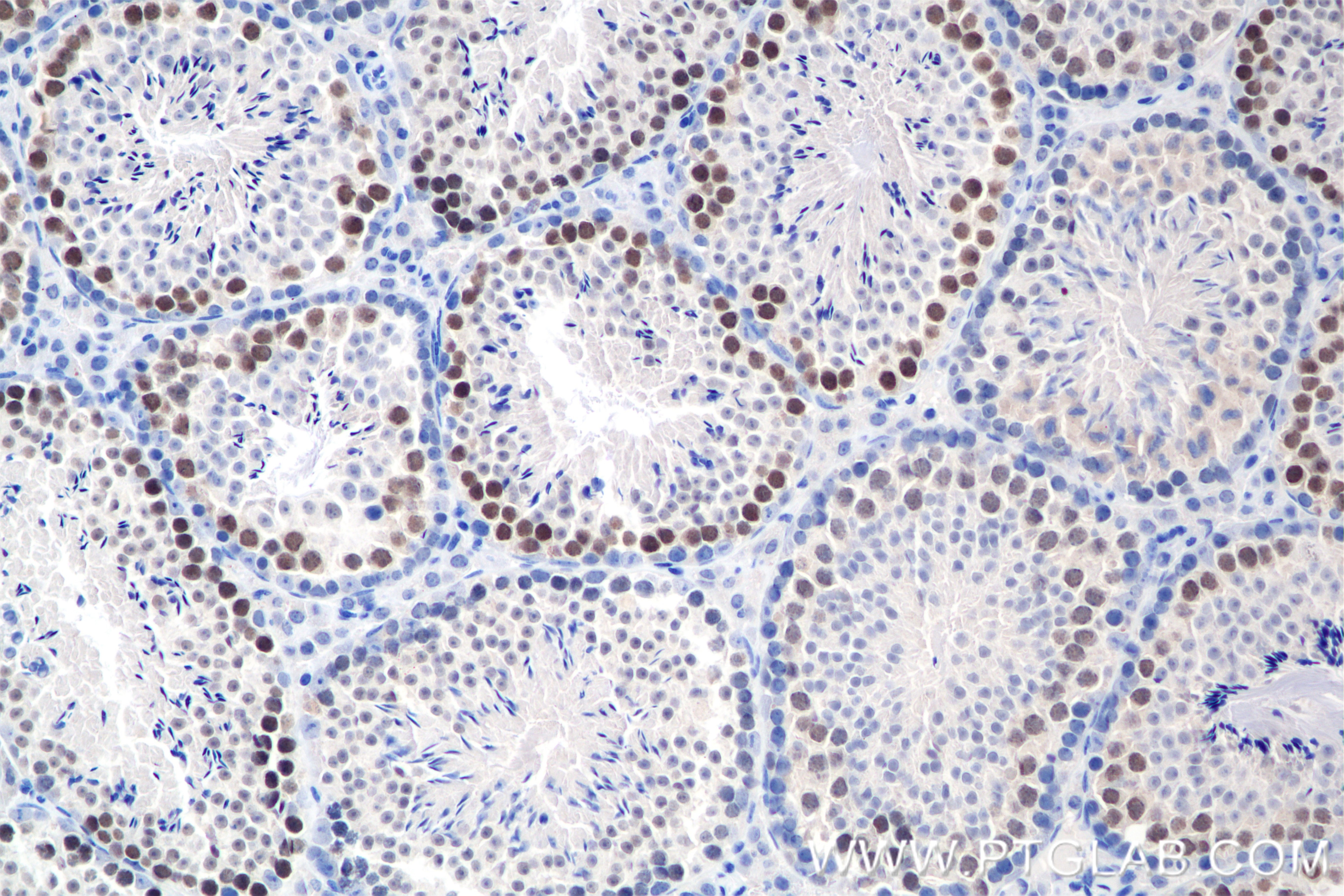 Immunohistochemistry (IHC) staining of mouse testis tissue using PSMC3IP Recombinant antibody (84934-1-RR)