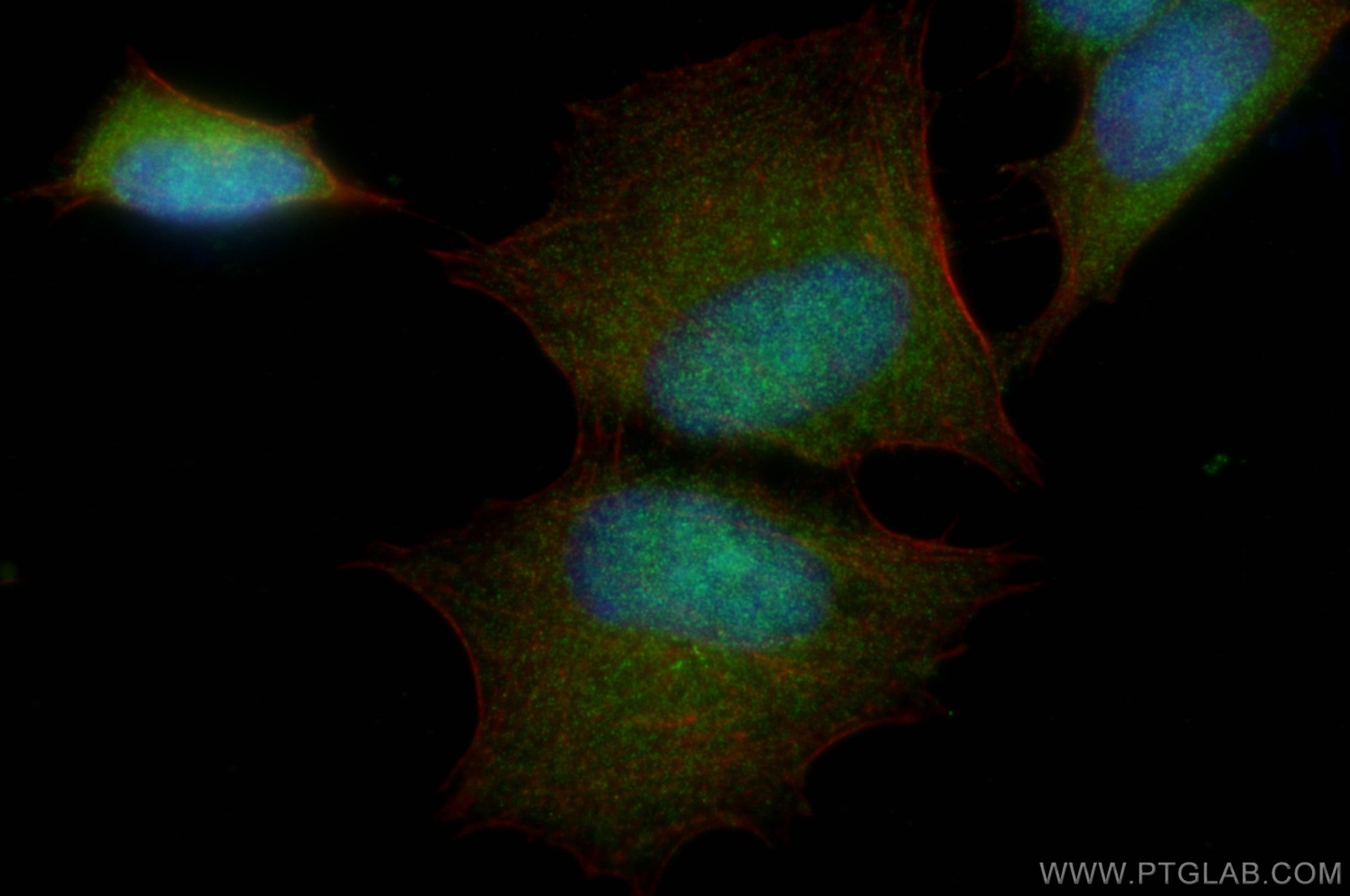 Immunofluorescence (IF) / fluorescent staining of SH-SY5Y cells using PSMC4 Polyclonal antibody (11389-1-AP)