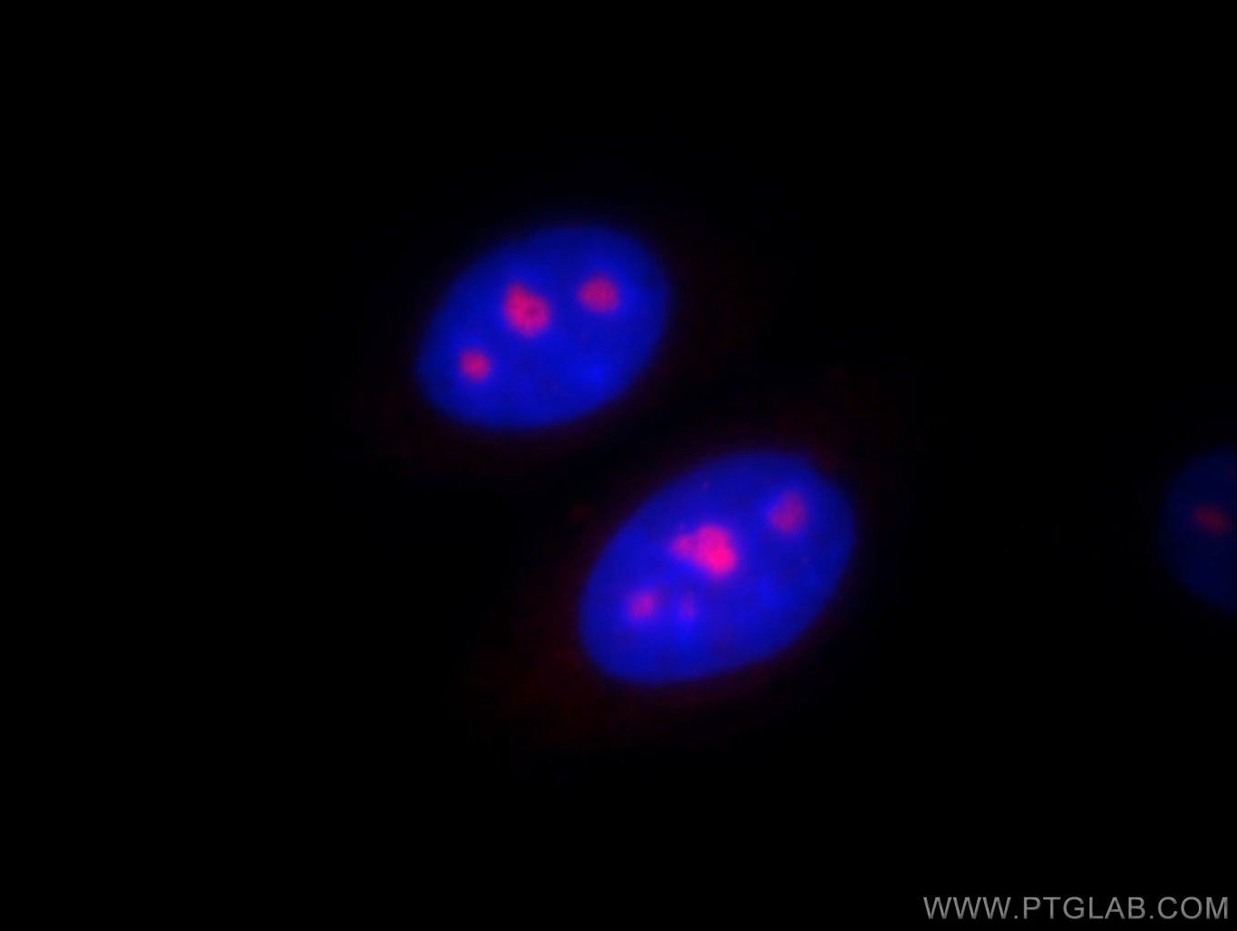 Immunofluorescence (IF) / fluorescent staining of HepG2 cells using PSMC4 Polyclonal antibody (11389-1-AP)