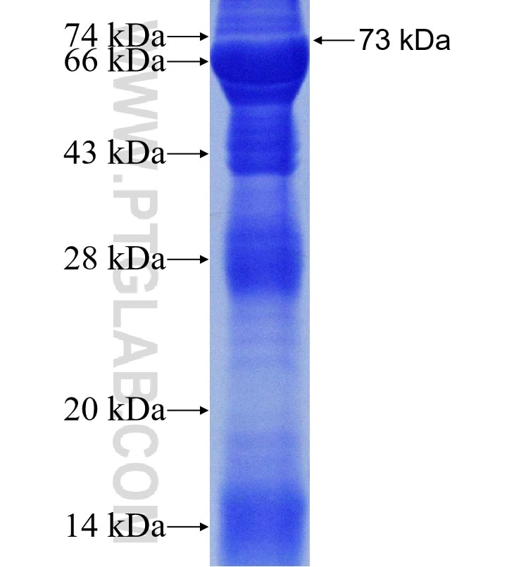 PSMC4 fusion protein Ag1943 SDS-PAGE