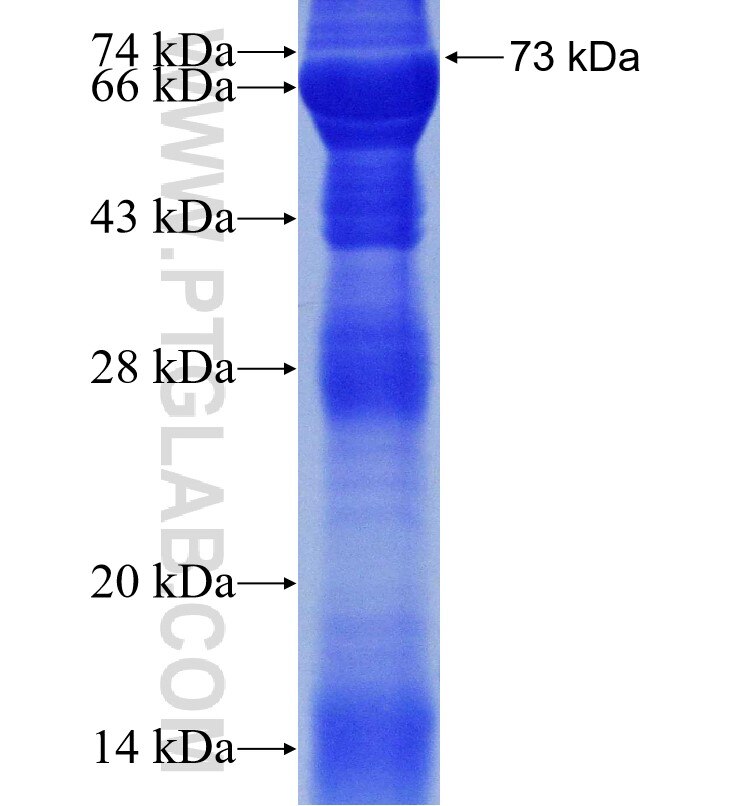 PSMC4 fusion protein Ag1943 SDS-PAGE