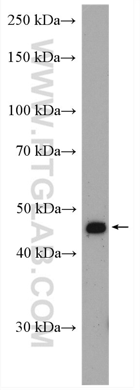 Western Blot (WB) analysis of A549 cells using PSMC5 Polyclonal antibody (14752-1-AP)
