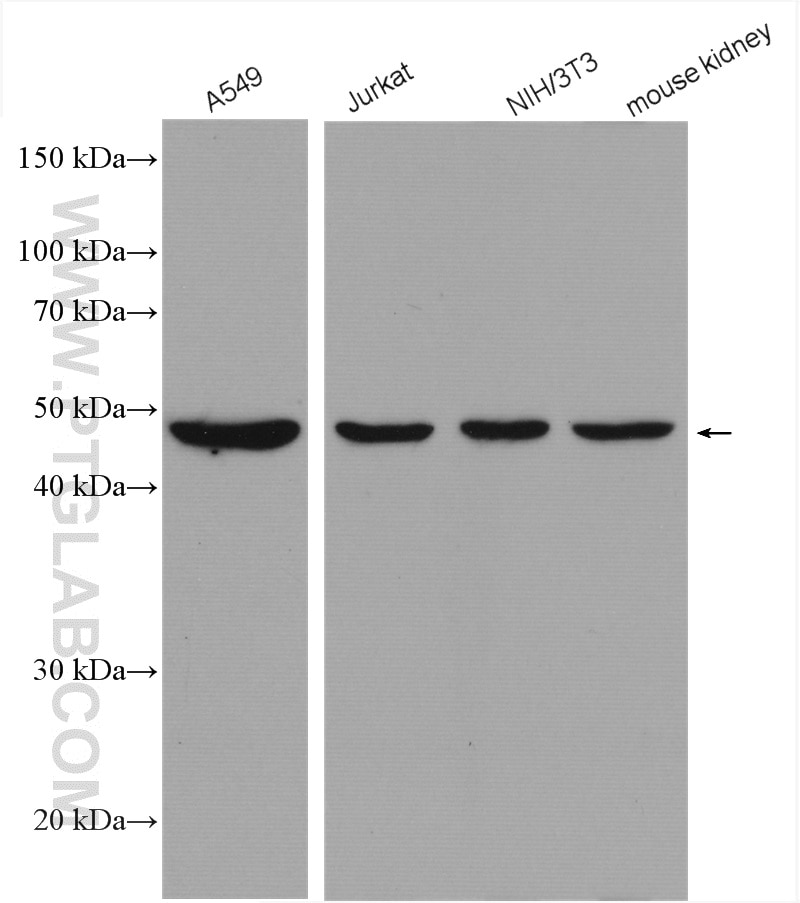 Western Blot (WB) analysis of various lysates using PSMC5 Polyclonal antibody (14752-1-AP)