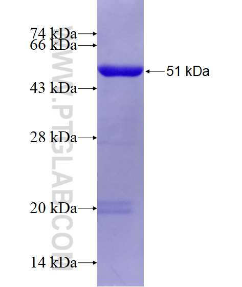 PSMC5 fusion protein Ag6549 SDS-PAGE
