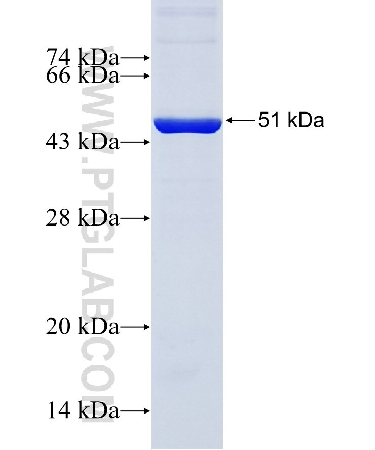 PSMC5 fusion protein Ag6549 SDS-PAGE