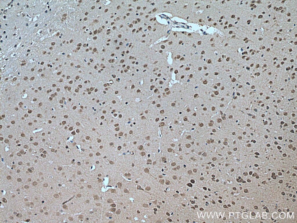 Immunohistochemistry (IHC) staining of mouse brain tissue using PSMC6 Polyclonal antibody (15839-1-AP)