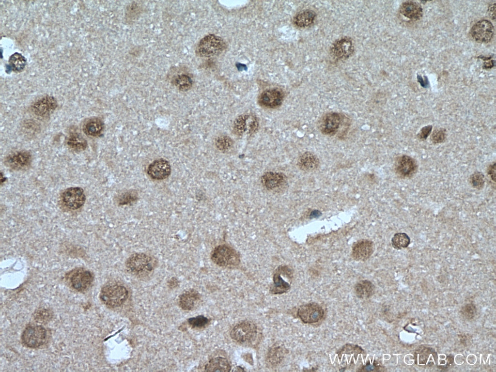 Immunohistochemistry (IHC) staining of mouse brain tissue using PSMC6 Polyclonal antibody (15839-1-AP)