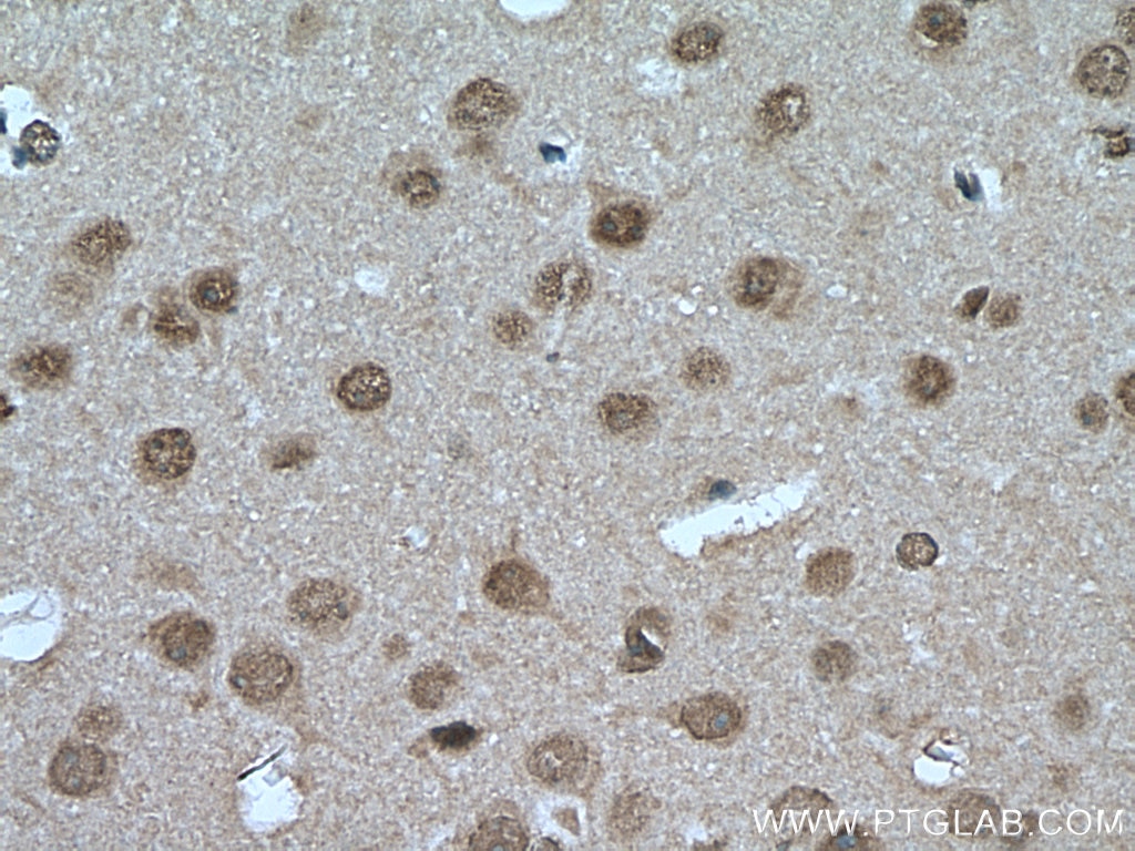 IHC staining of mouse brain using 15839-1-AP