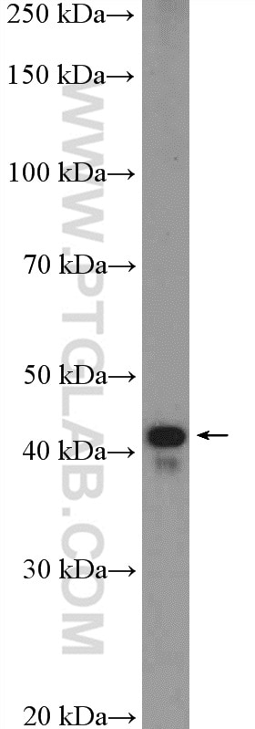 Western Blot (WB) analysis of mouse brain tissue using PSMC6 Polyclonal antibody (15839-1-AP)