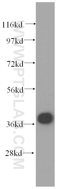 Western Blot (WB) analysis of human brain tissue using PSMC6 Polyclonal antibody (15839-1-AP)