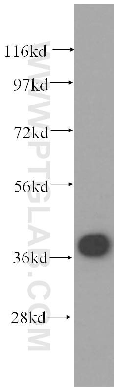 WB analysis of human brain using 15839-1-AP