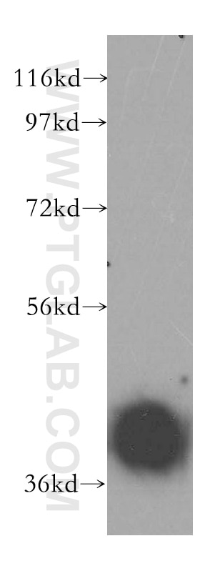 Western Blot (WB) analysis of human testis tissue using PSMC6 Polyclonal antibody (15839-1-AP)