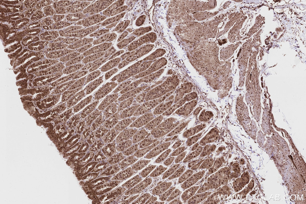 Immunohistochemistry (IHC) staining of mouse stomach tissue using PSMD1 Recombinant monoclonal antibody (83521-2-RR)