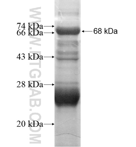 PSMD1 fusion protein Ag12009 SDS-PAGE