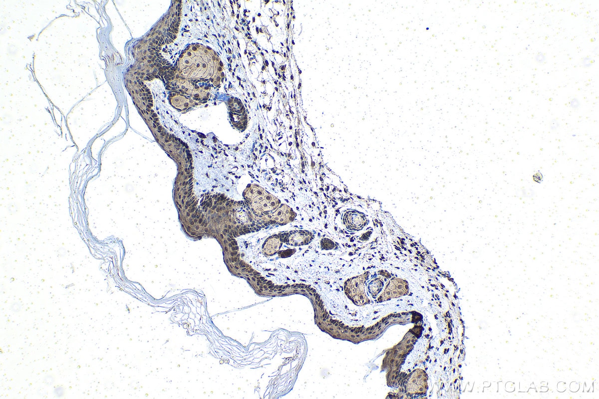 IHC staining of mouse skin using 12342-2-AP