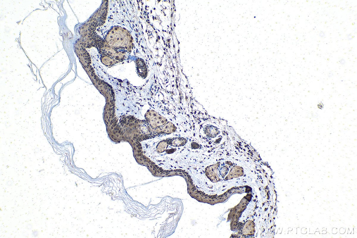Immunohistochemistry (IHC) staining of mouse skin tissue using PSMD10/Gankyrin Polyclonal antibody (12342-2-AP)