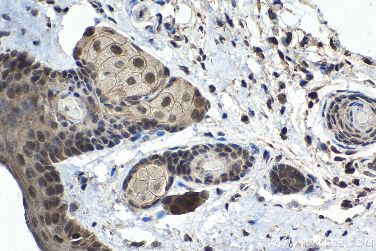 Immunohistochemistry (IHC) staining of mouse skin tissue using PSMD10 Polyclonal antibody (12342-2-AP)