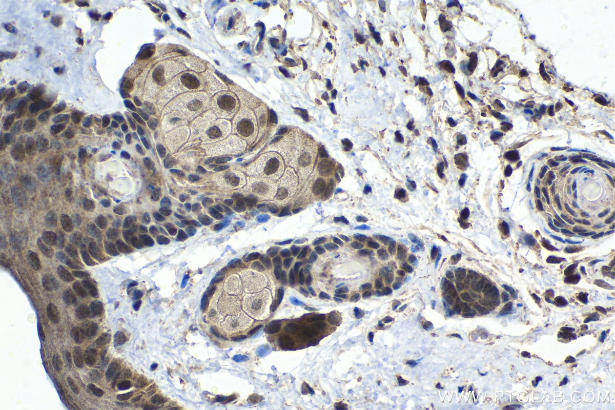 Immunohistochemistry (IHC) staining of mouse skin tissue using PSMD10/Gankyrin Polyclonal antibody (12342-2-AP)