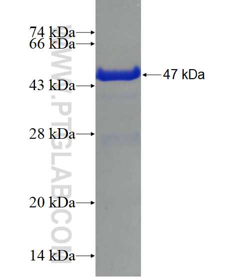 PSMD10 fusion protein Ag2994 SDS-PAGE