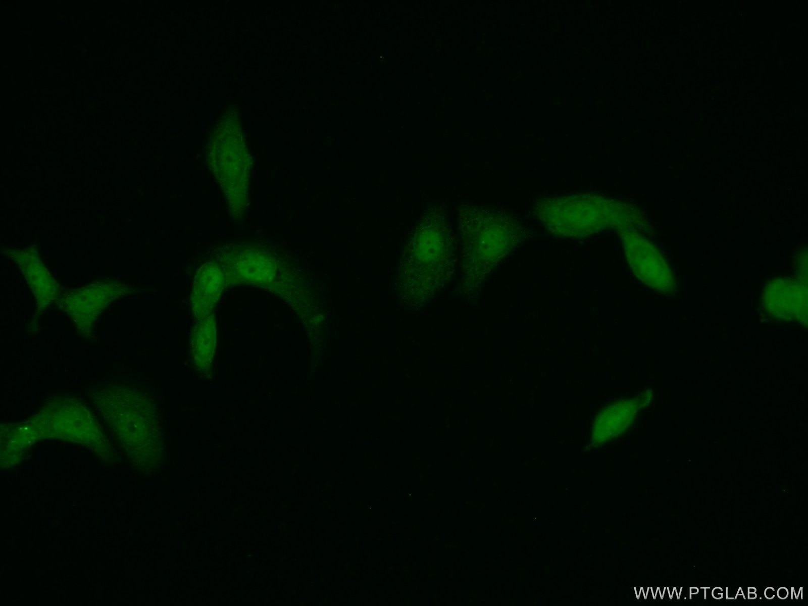 IF Staining of MCF-7 using 14786-1-AP