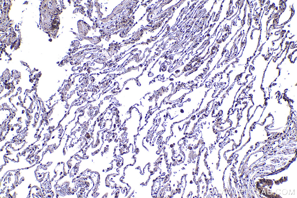 Immunohistochemistry (IHC) staining of human lung tissue using PSMD11 Polyclonal antibody (14786-1-AP)