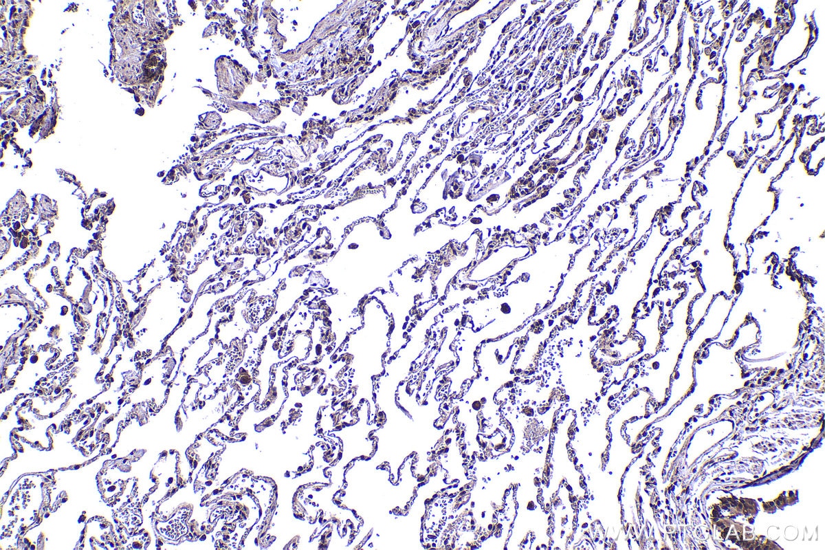 IHC staining of human lung using 14786-1-AP