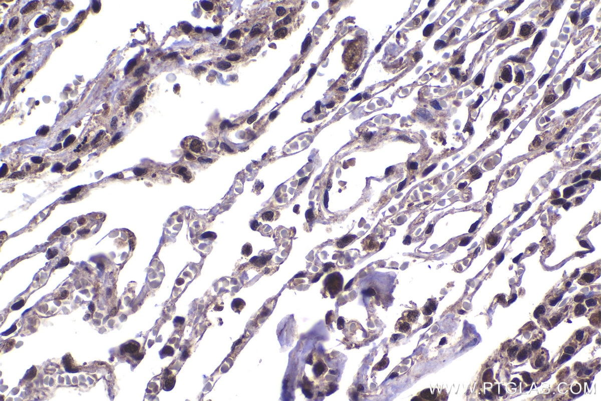 IHC staining of human lung using 14786-1-AP