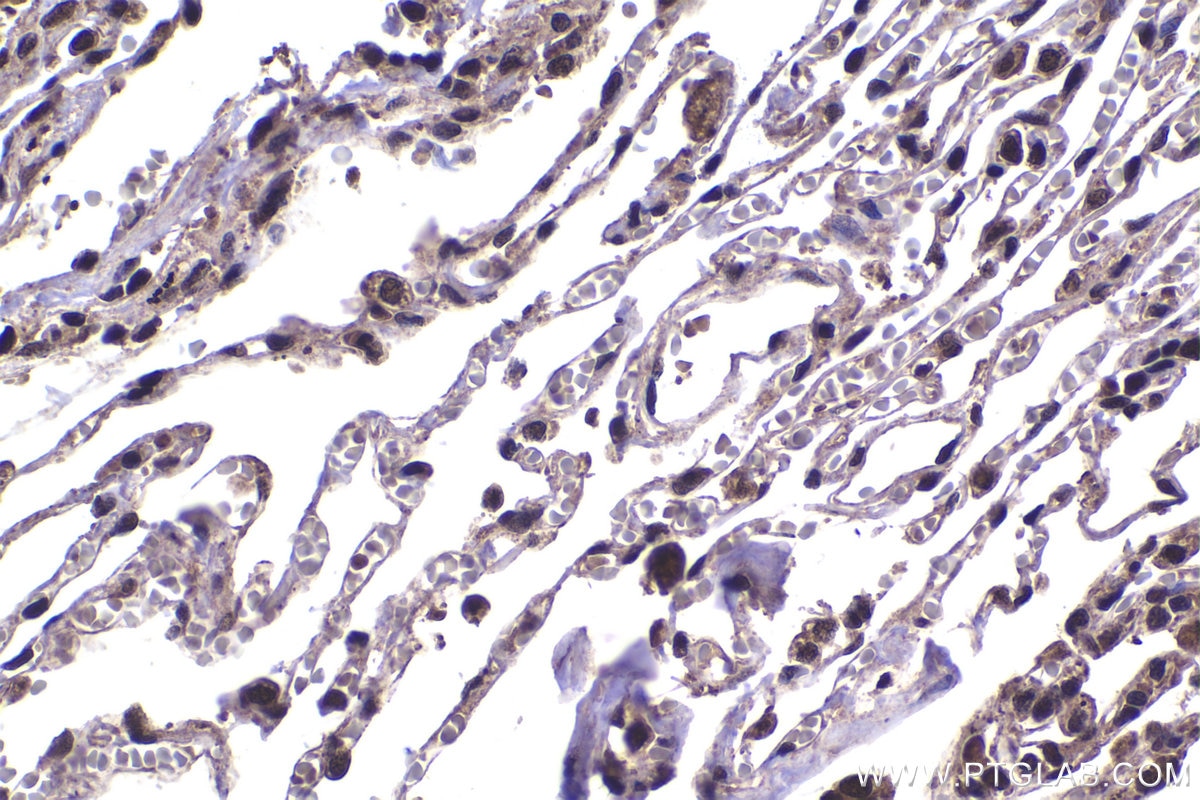 Immunohistochemistry (IHC) staining of human lung tissue using PSMD11 Polyclonal antibody (14786-1-AP)