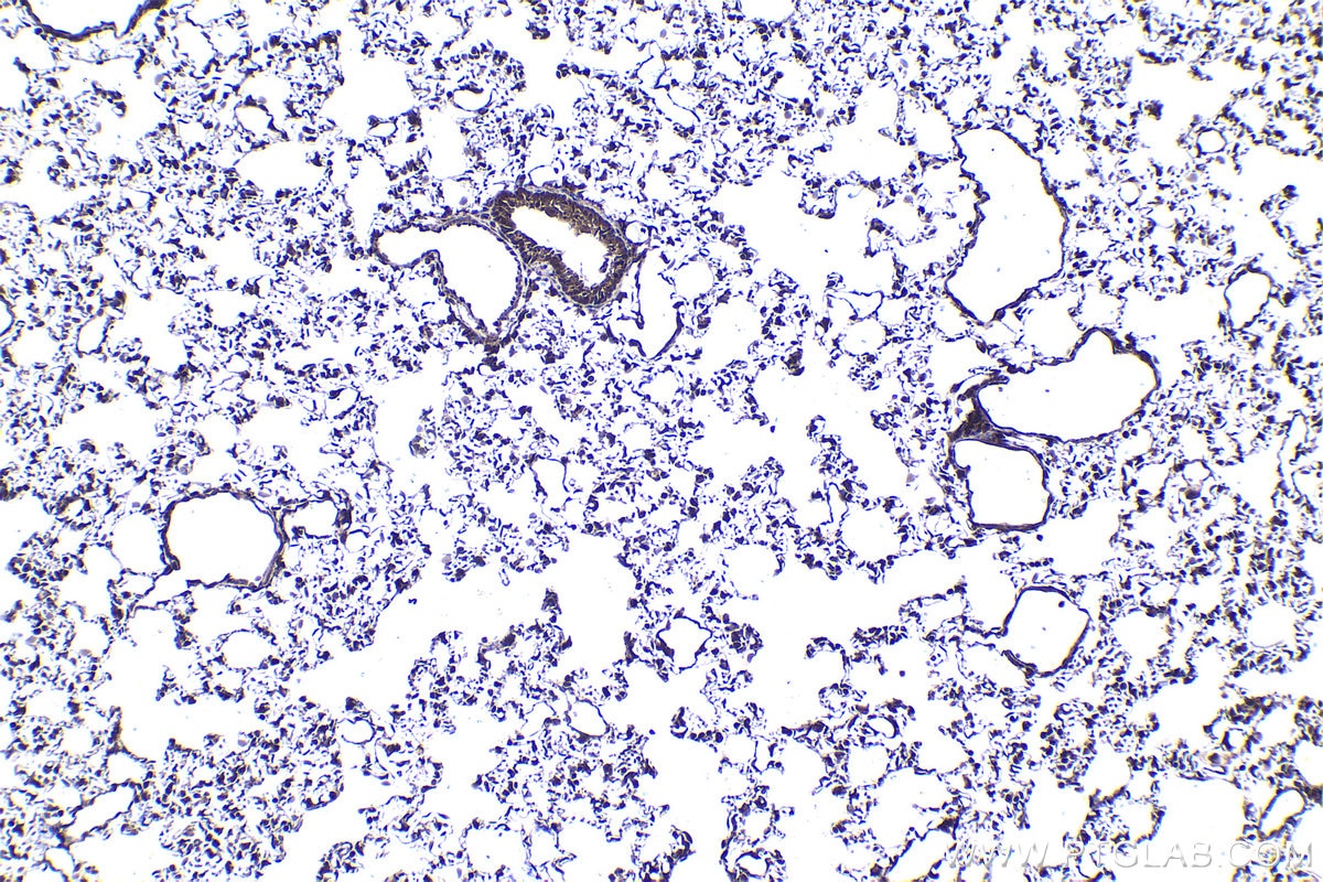 Immunohistochemistry (IHC) staining of rat lung tissue using PSMD11 Polyclonal antibody (14786-1-AP)