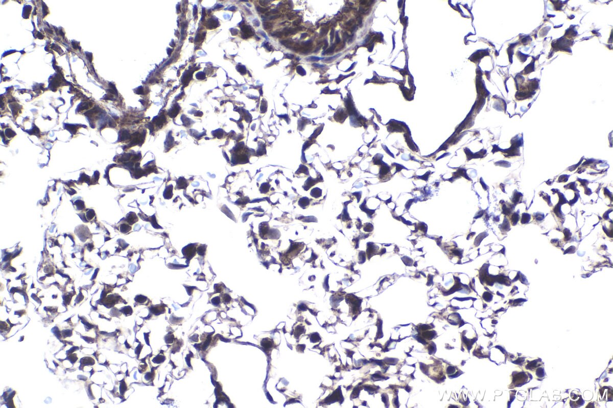IHC staining of rat lung using 14786-1-AP