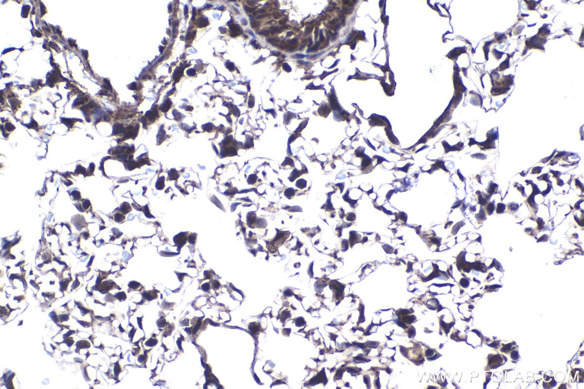 Immunohistochemistry (IHC) staining of rat lung tissue using PSMD11 Polyclonal antibody (14786-1-AP)