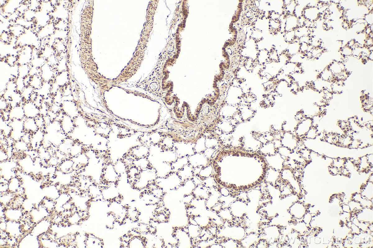Immunohistochemistry (IHC) staining of rat lung tissue using PSMD11 Polyclonal antibody (14786-1-AP)