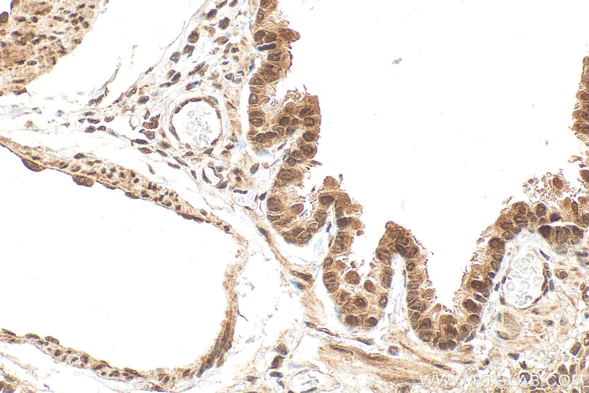 Immunohistochemistry (IHC) staining of rat lung tissue using PSMD11 Polyclonal antibody (14786-1-AP)