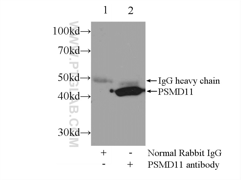 Immunoprecipitation (IP) experiment of MCF-7 cells using PSMD11 Polyclonal antibody (14786-1-AP)