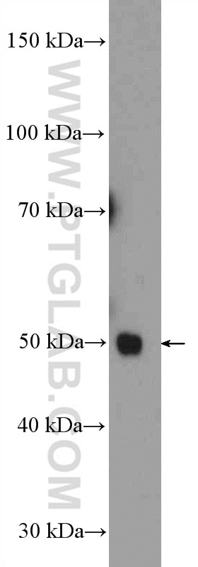 Western Blot (WB) analysis of rat brain tissue using PSMD11 Polyclonal antibody (14786-1-AP)