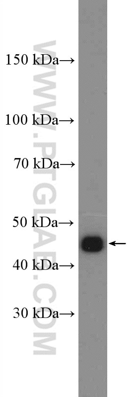 Western Blot (WB) analysis of HeLa cells using PSMD11 Polyclonal antibody (14786-1-AP)