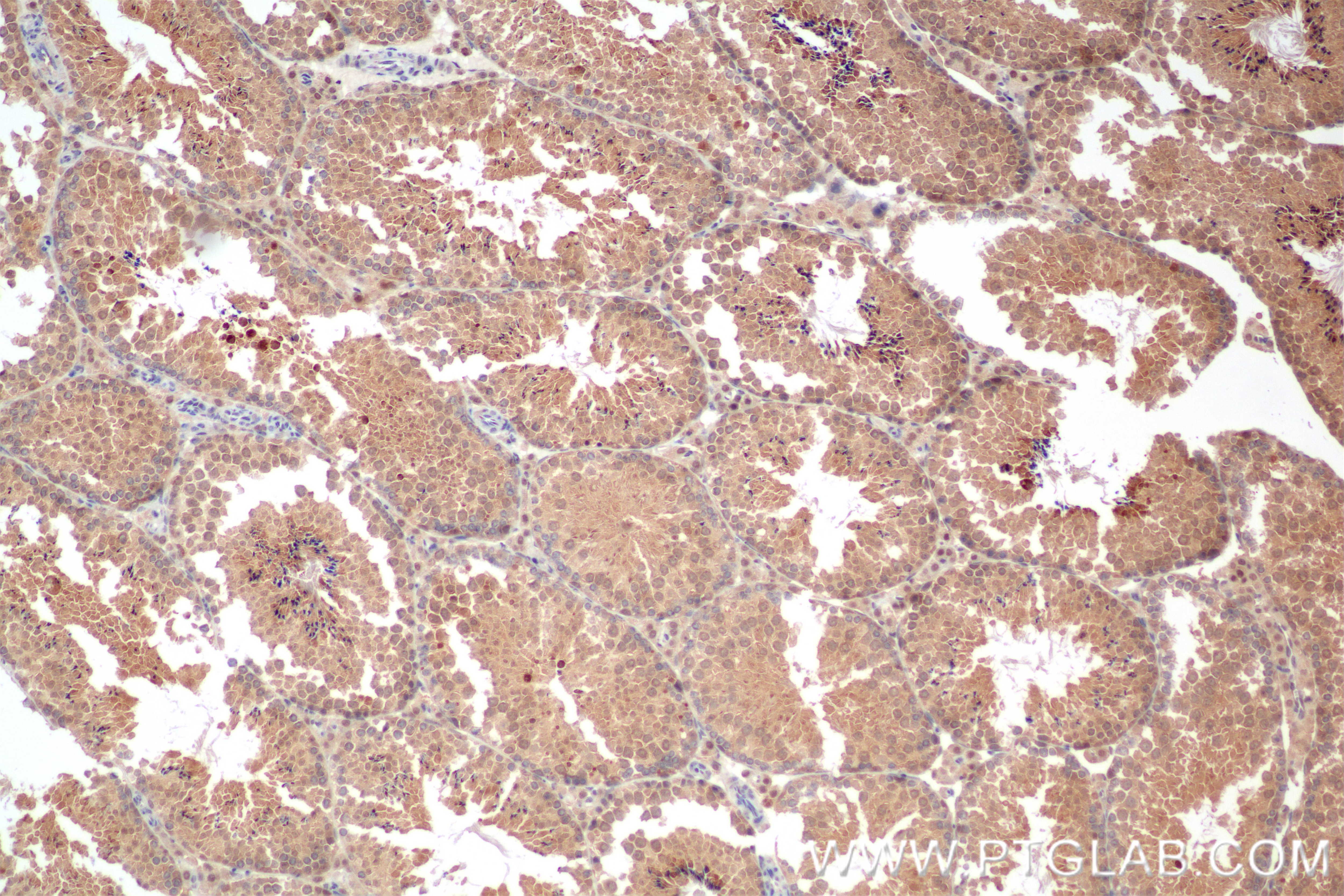 Immunohistochemistry (IHC) staining of mouse testis tissue using PSMD11 Recombinant monoclonal antibody (86596-3-RR)