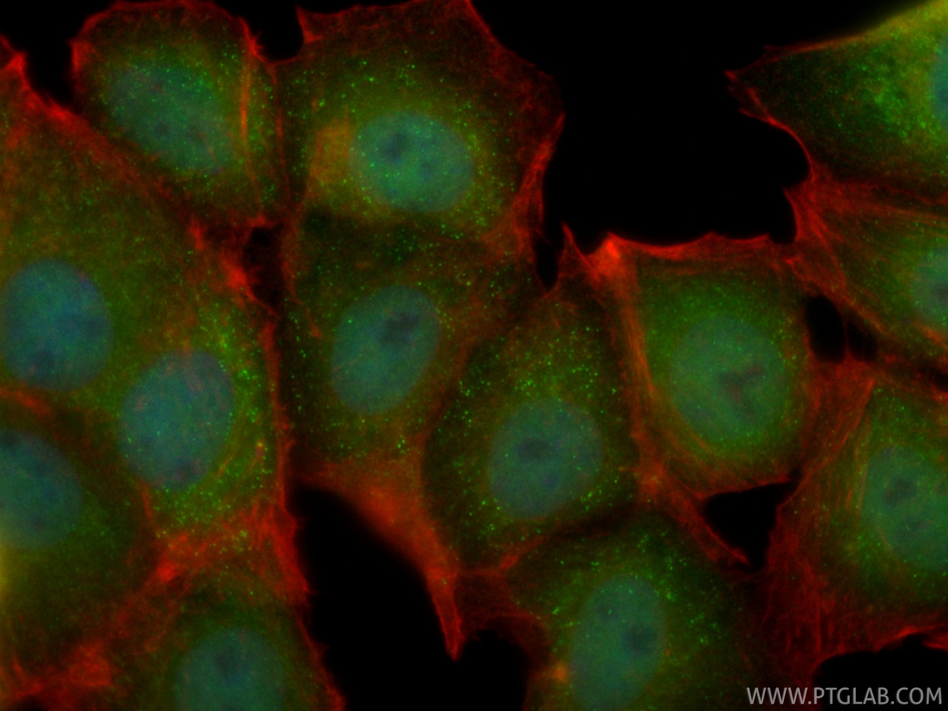 Immunofluorescence (IF) / fluorescent staining of MCF-7 cells using CoraLite® Plus 488-conjugated PSMD11 Recombinant m (CL488-86596-3)